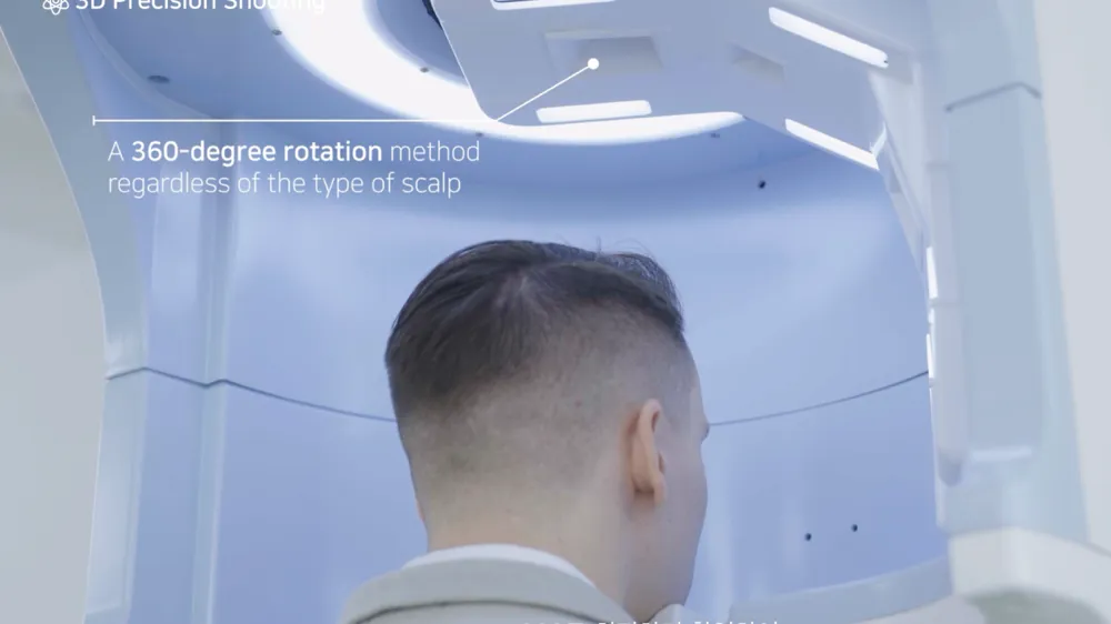 Innovative Hair Loss Diagnostic System, Hair Scale, AFS 3D